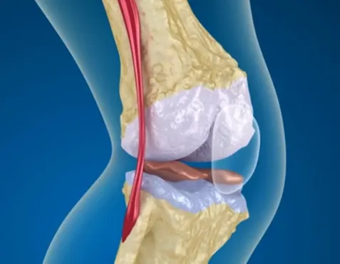 Joint-Glide-Benefits