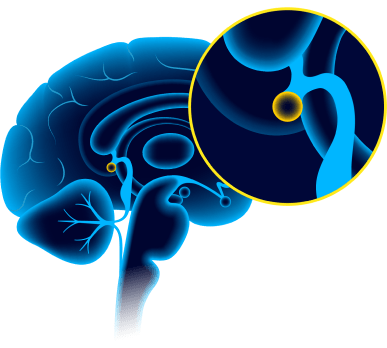 Quantum Attraction Code Benefit